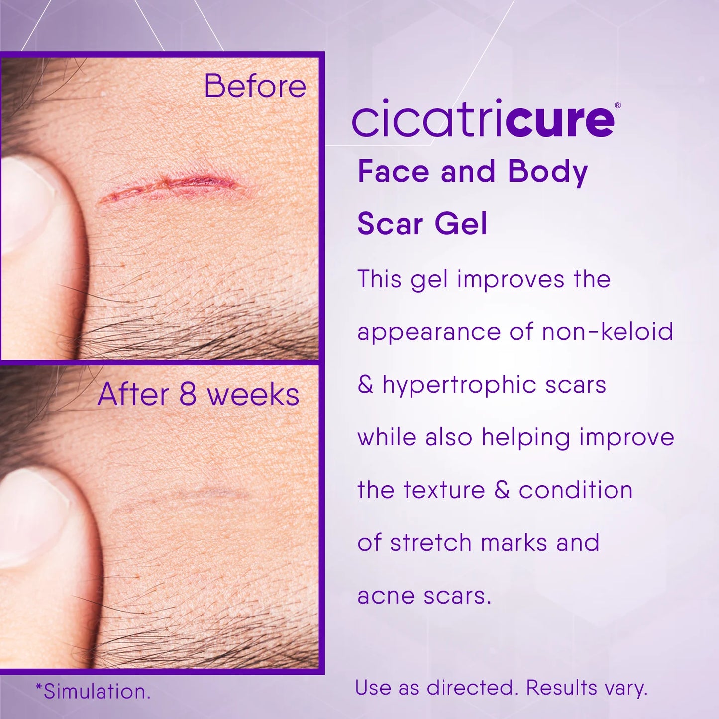Scar Reducing Cream, Face & Body Scar Gel, 1 Oz (2 Pack)