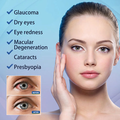 Gentle Daily Eye Comfort Refresh Treatment