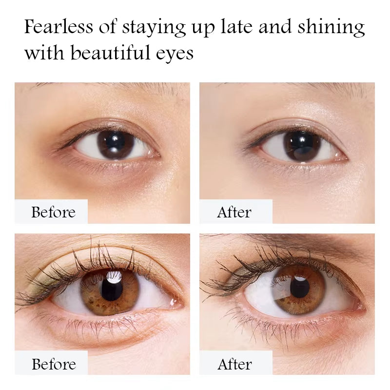 1/2/3Pcs Gold Caviar Eye Cream anti Dark Circle Removal Eyes Bags Moisturizing Firming Eye Creams Eyes Skin Care Products