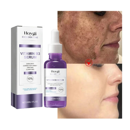 Dark Spots Remover Whitening Serum Face Freckle Melanin Correcting anti Pigmentation Brighten Beauty Korean Day Night Skin Care