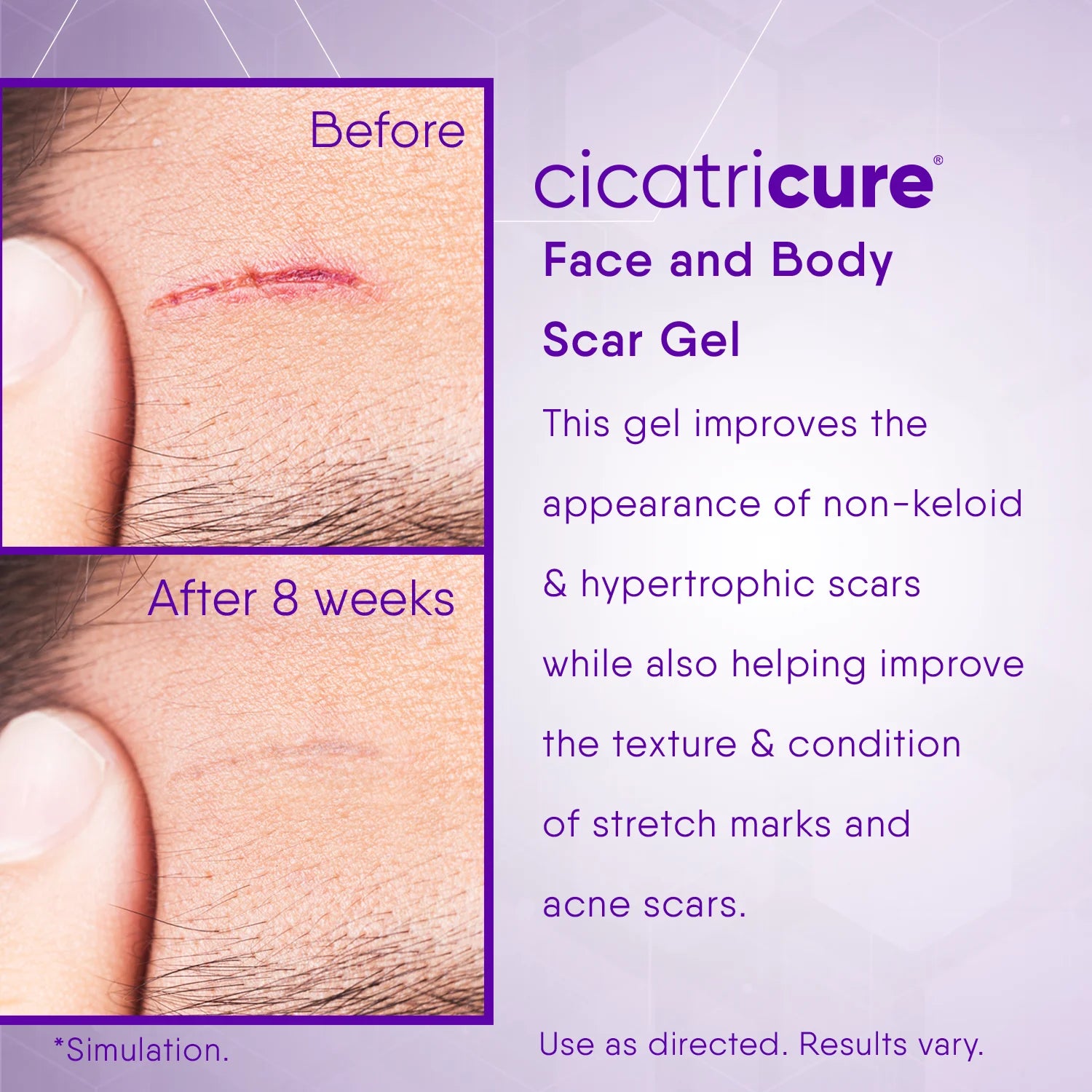 Scar Reducing Cream, Face & Body Scar Gel, 1 Oz (2 Pack)