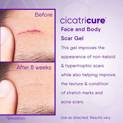 Scar Reducing Cream, Face & Body Scar Gel, 1 Oz (2 Pack)